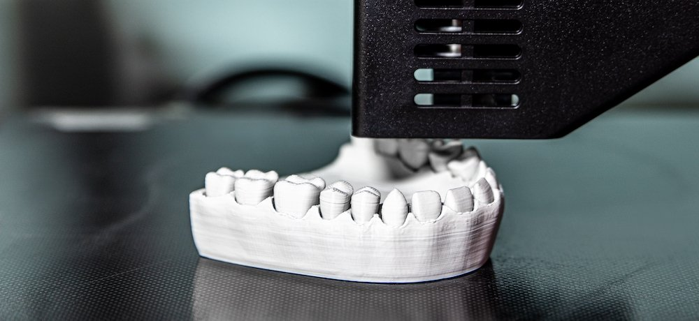 BMF Launches World's Thinnest 3D Dental Veneer