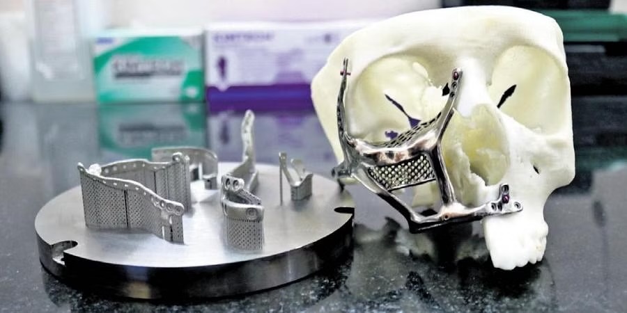 The 3D-printed face implants use medical-grade titanium