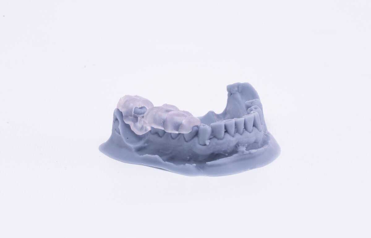 3D-Printed-Surgical-Guide-on-a-Dental-Impression | Manufactur3D