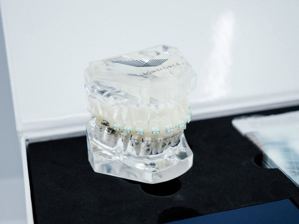 3D Printed Brace Maker LightForce Orthodontics Raises $80 Million